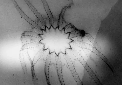 Fossilienankauf_Bundenbach_Röntgen